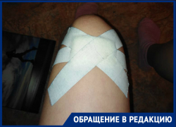 16-летнюю волгодончанку искусала собака, хозяин которой спокойно наблюдал за зверством 16-летнюю волгодончанку искусала собака, хозяин которой спокойно наблюдал за зверством