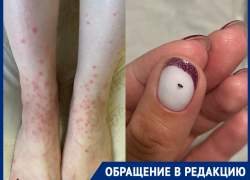 «Блохи даже в кровати»: насекомые из подвала МКД искусали волгодонцев «Блохи даже в кровати»: насекомые из подвала МКД искусали волгодонцев