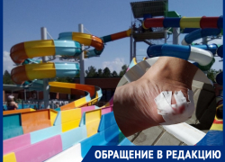 «Экстремальная база отдыха»: волгодонец рассказал, как покалечился на «Донской волне» «Экстремальная база отдыха»: волгодонец рассказал, как покалечился на «Донской волне»