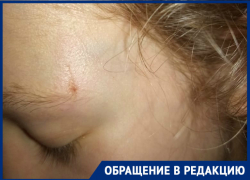 13-летняя волгодончанка ушибла голову в маршрутке при резком торможении 13-летняя волгодончанка ушибла голову в маршрутке при резком торможении