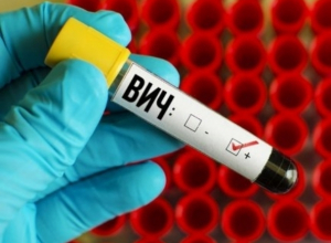 Число ВИЧ-инфицированных в Волгодонске продолжает расти Число ВИЧ-инфицированных в Волгодонске продолжает расти