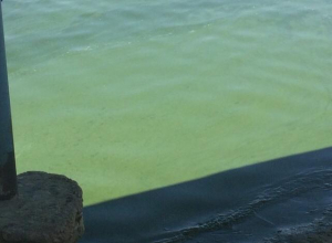 После купания в Цимлянском водохранилище у волгодонца «позеленели» ноги После купания в Цимлянском водохранилище у волгодонца «позеленели» ноги
