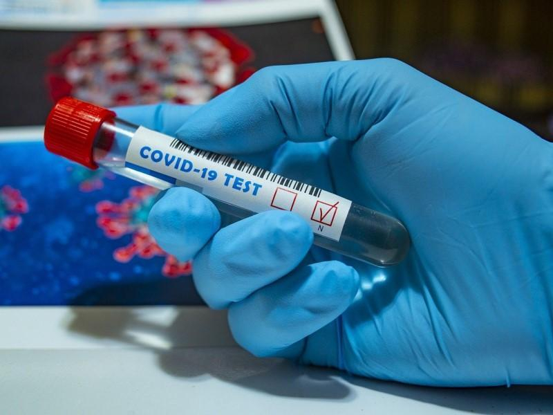 На 16 человек увеличилось число инфицированных Covid-19 в Волгодонске и районе На 16 человек увеличилось число инфицированных Covid-19 в Волгодонске и районе