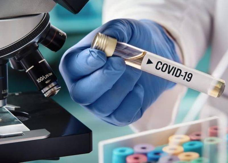 У девяти волгодонцев за сутки выявили Covid-19: в области 389 заболевших У девяти волгодонцев за сутки выявили Covid-19: в области 389 заболевших