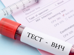 В Волгодонске каждый желающий может пройти бесплатное тестирование крови на ВИЧ-инфекцию
