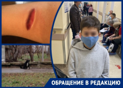 Рваная рана и дикий испуг: ребенка погрызли собаки неподалеку от администрации Волгодонска