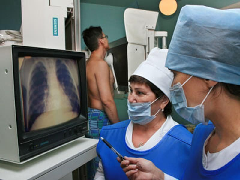 В Волгодонске врачи рассказали, у кого больше всего шансов заболеть туберкулезом