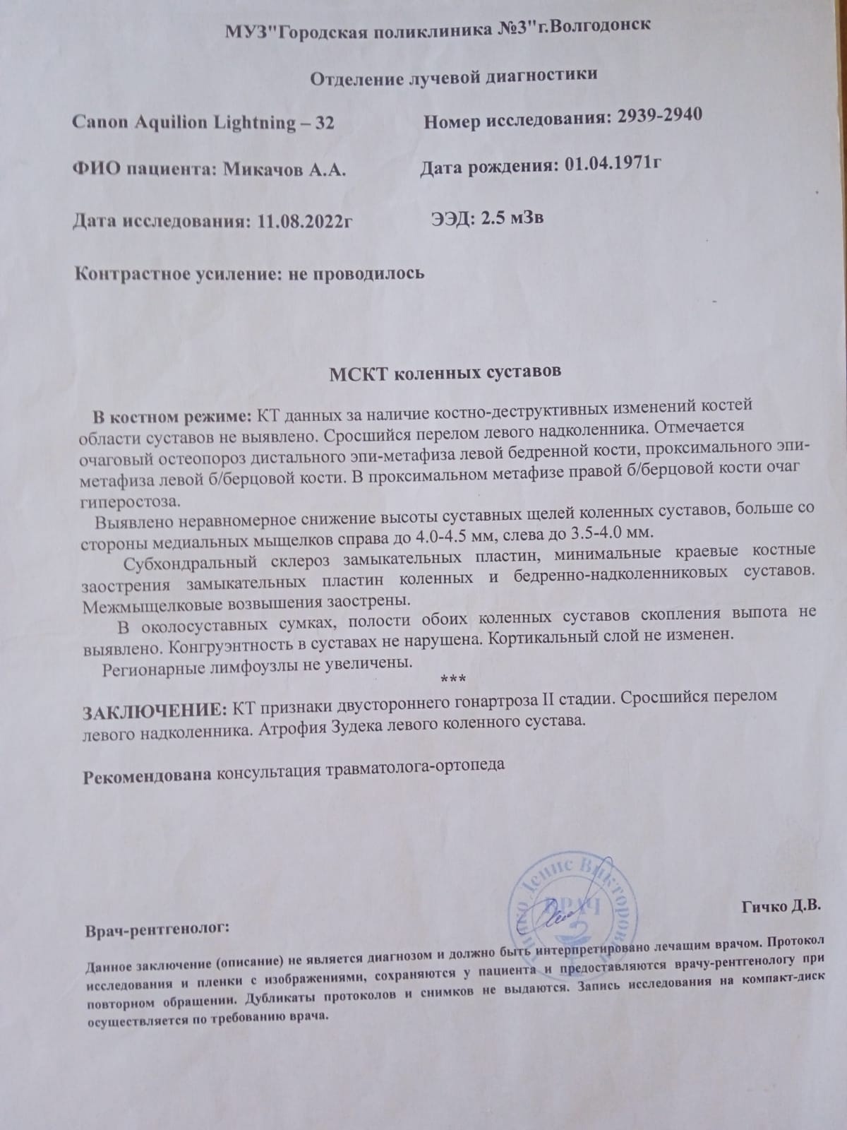 Я стал калекой»: несчастный случай на предприятии «Росатома» превратил в ад  жизнь волгодонца